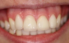 Smile Gallery - Church Road Dental and Cosmetic