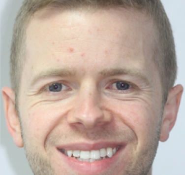 Smile Gallery - Church Road Dental and Cosmetic