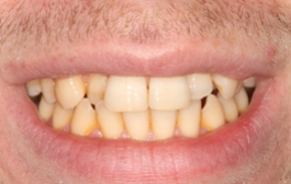 Smile Gallery - Church Road Dental and Cosmetic