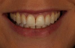 Smile Gallery - Church Road Dental and Cosmetic