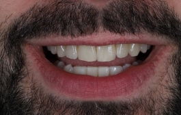 Smile Gallery - Church Road Dental and Cosmetic