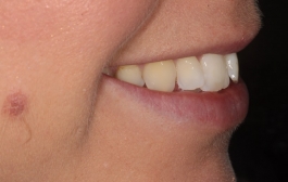 Smile Gallery - Church Road Dental and Cosmetic