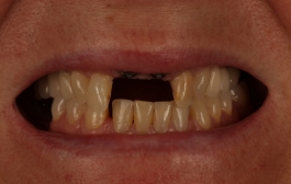 Smile Gallery - Church Road Dental and Cosmetic