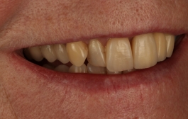 Smile Gallery - Church Road Dental and Cosmetic