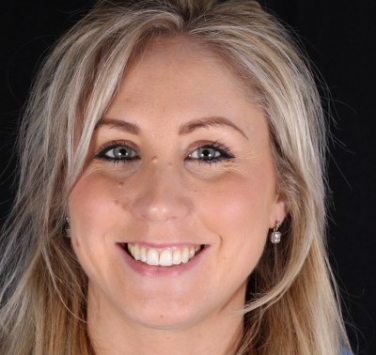 Smile Gallery - Church Road Dental and Cosmetic