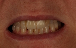Smile Gallery - Church Road Dental and Cosmetic