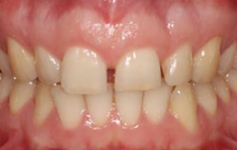 Smile Gallery - Church Road Dental and Cosmetic