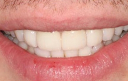 Smile Gallery - Church Road Dental and Cosmetic