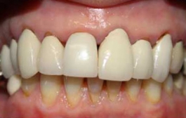 Smile Gallery - Church Road Dental and Cosmetic