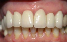 Smile Gallery - Church Road Dental and Cosmetic