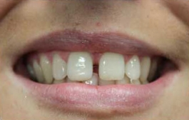 Smile Gallery - Church Road Dental and Cosmetic