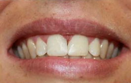 Smile Gallery - Church Road Dental and Cosmetic
