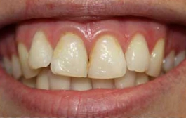Smile Gallery - Church Road Dental and Cosmetic