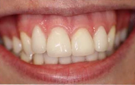 Smile Gallery - Church Road Dental and Cosmetic