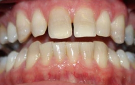 Smile Gallery - Church Road Dental and Cosmetic