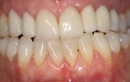 Smile Gallery - Church Road Dental and Cosmetic