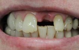 Smile Gallery - Church Road Dental and Cosmetic