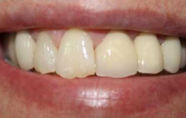Smile Gallery - Church Road Dental and Cosmetic