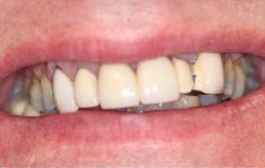 Smile Gallery - Church Road Dental and Cosmetic