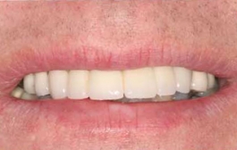 Smile Gallery - Church Road Dental and Cosmetic