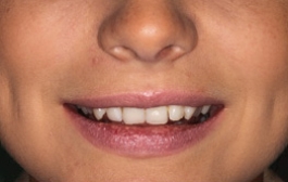 Smile Gallery - Church Road Dental and Cosmetic