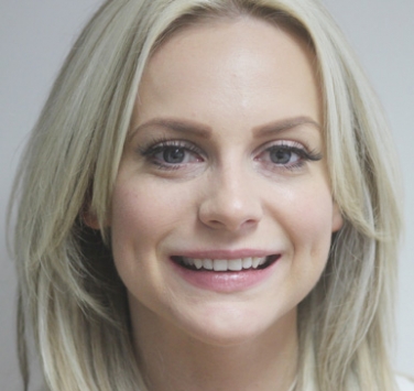 Smile Gallery - Church Road Dental and Cosmetic