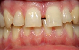 Smile Gallery - Church Road Dental and Cosmetic