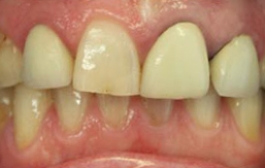 Smile Gallery - Church Road Dental and Cosmetic