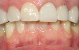Smile Gallery - Church Road Dental and Cosmetic