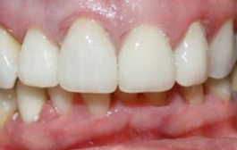 Smile Gallery - Church Road Dental and Cosmetic