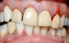 Smile Gallery - Church Road Dental and Cosmetic