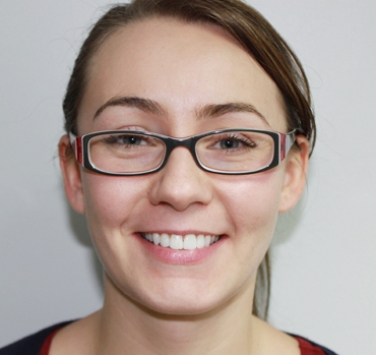 Smile Gallery - Church Road Dental and Cosmetic
