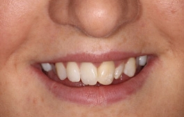 Smile Gallery - Church Road Dental and Cosmetic