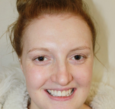 Smile Gallery - Church Road Dental and Cosmetic