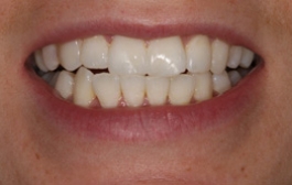 Smile Gallery - Church Road Dental and Cosmetic