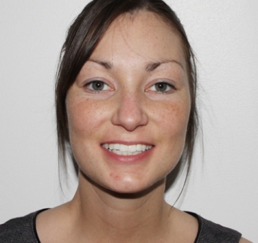 Smile Gallery - Church Road Dental and Cosmetic