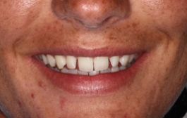 Smile Gallery - Church Road Dental and Cosmetic