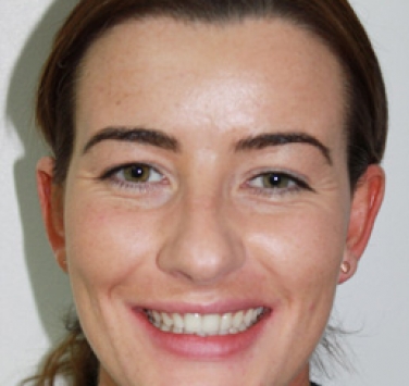Smile Gallery - Church Road Dental and Cosmetic