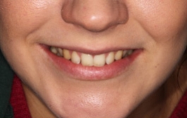 Smile Gallery - Church Road Dental and Cosmetic