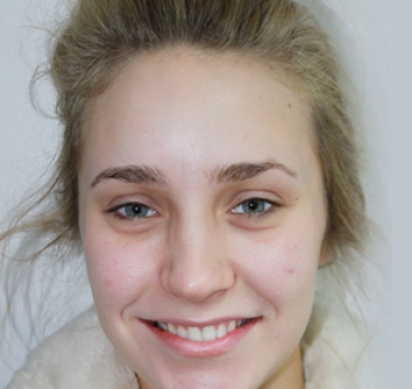 Smile Gallery - Church Road Dental and Cosmetic