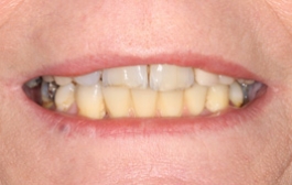 Smile Gallery - Church Road Dental and Cosmetic