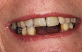 Smile Gallery - Church Road Dental and Cosmetic