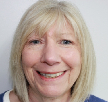 Smile Gallery - Church Road Dental and Cosmetic