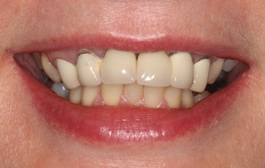 Smile Gallery - Church Road Dental and Cosmetic