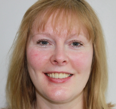 Smile Gallery - Church Road Dental and Cosmetic