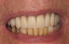 Smile Gallery - Church Road Dental and Cosmetic