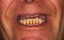 Smile Gallery - Church Road Dental and Cosmetic