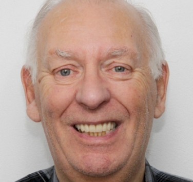 Smile Gallery - Church Road Dental and Cosmetic