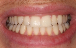 Smile Gallery - Church Road Dental and Cosmetic