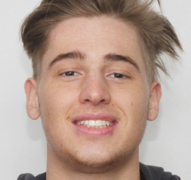 Smile Gallery - Church Road Dental and Cosmetic